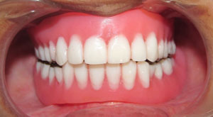 Protetik Diş Hekimliği